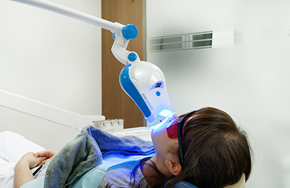 ホワイトニング